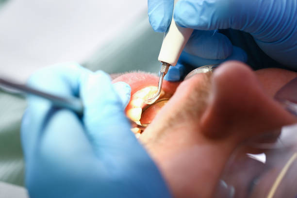Best Tooth Infection Emergency Dentist  in Mammoth Spring, AR
