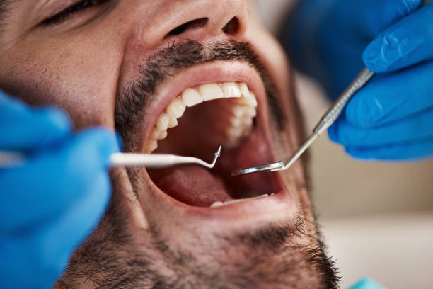 Best Knocked-Out Tooth Emergency  in Mammoth Spring, AR